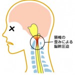 keitui2